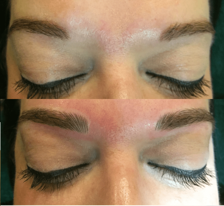 Before and after initial treatment